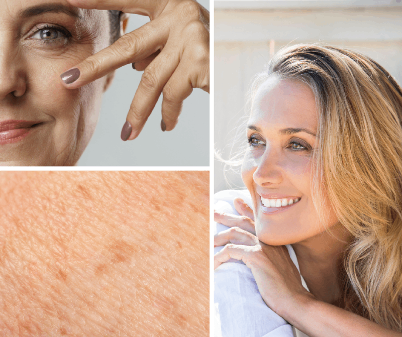 Pro koho je sérum Lys Active vhodné